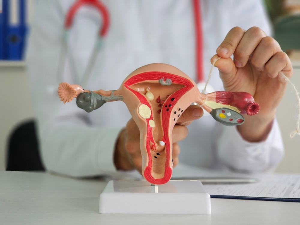 Cervical Cancer Screening in Kenya: Why Every Woman Over 25 Should Get Tested